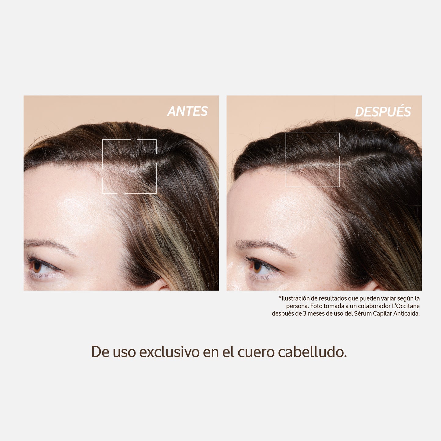 Sérum Capilar Anticaída 50ml