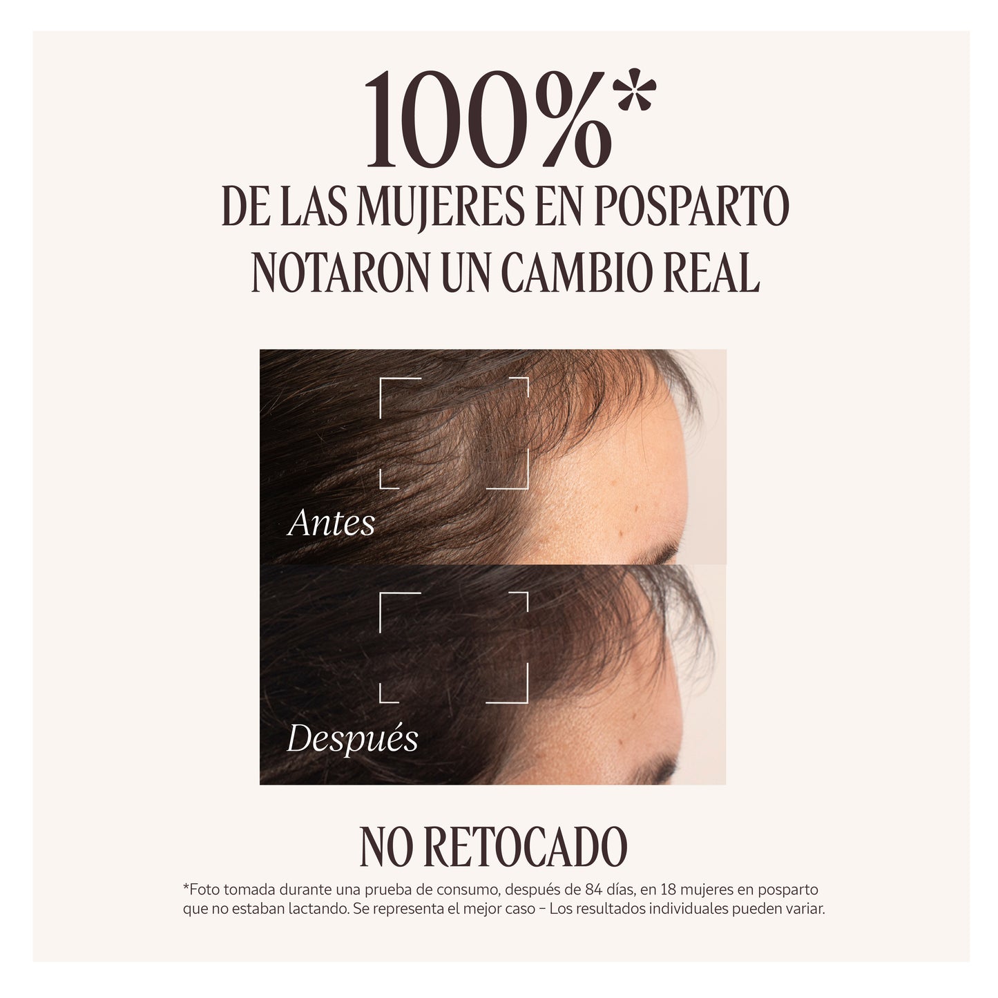 Sérum Capilar Anticaída 50ml