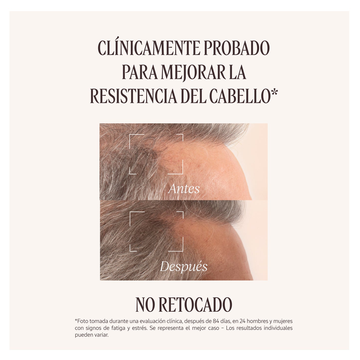 Sérum Capilar Anticaída 50ml